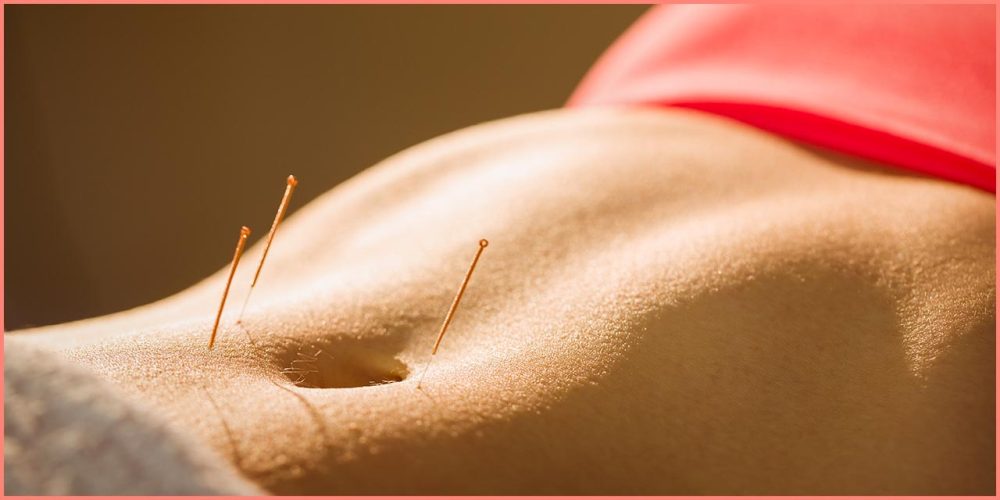 Exercice de l&rsquo;acupuncture